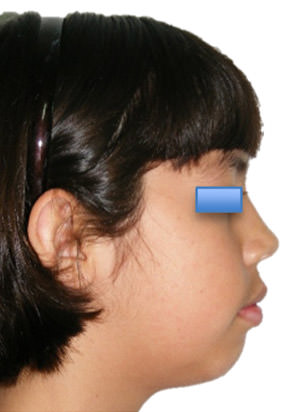 Fig. 11 Perfil progreso I