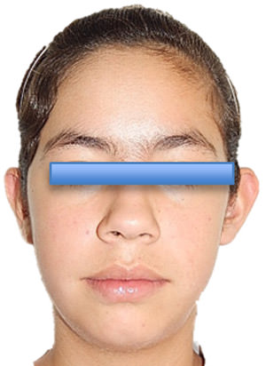 Fig. 14 Frente final