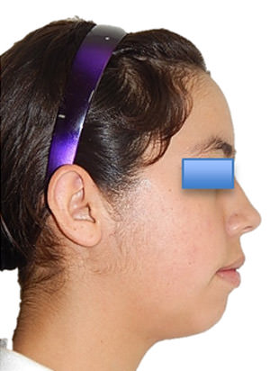 Fig. 15 Perfil