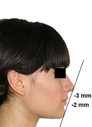 Fig 2 Perfil