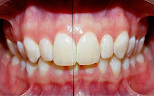 Fig 3 Frente