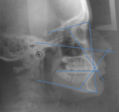 Fig 6 Rx lateral de cráneo