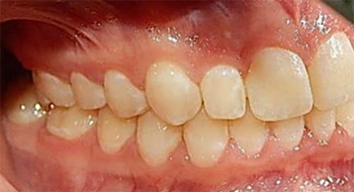 Fig 14 Derecha