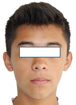 Fig.1 Inicial de frente