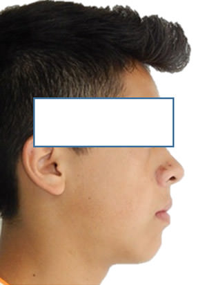 Fig. 2 Perfil