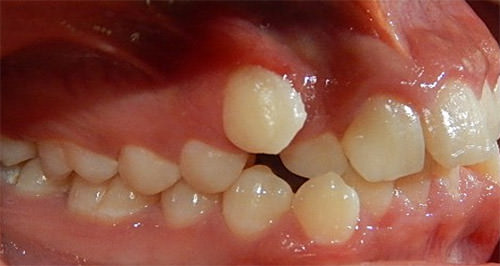 Fig. 4 Lateral derecha