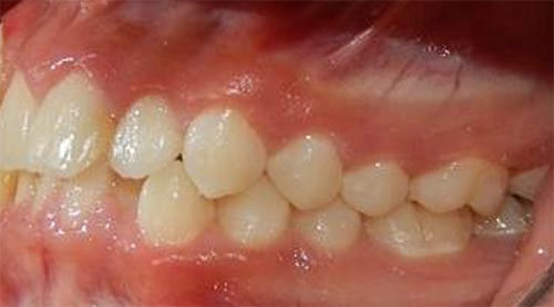 Fig. 5 Lateral izquierda