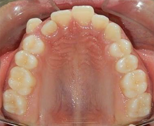 Fig. 6 Oclusal superior