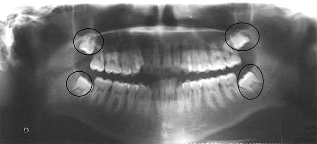 Fig. 9 Radiografía panorámica