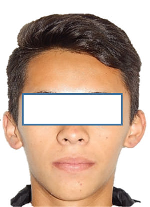 Fig. 11 Final de frente