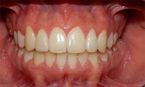 Fig. 14 Frente