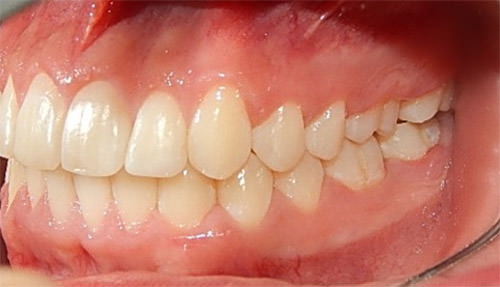 Fig. 16 Lateral izquierda