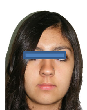 Figura 1 Frente