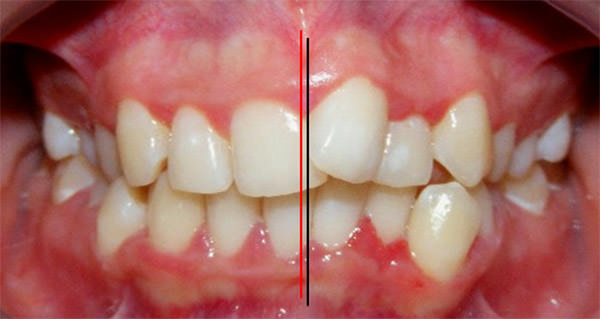 Figura 9 Intraoral de frente