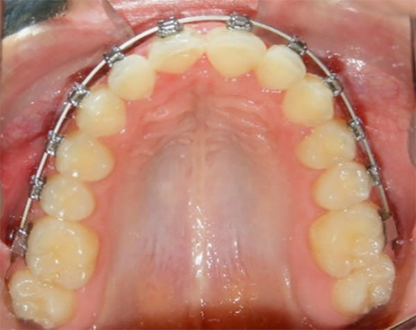 Fig. 17 Oclusal superior