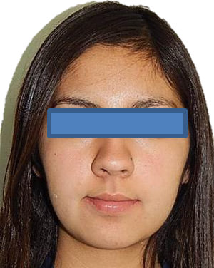 Fig. 19 Frente