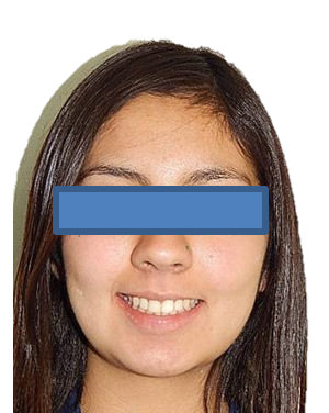 Fig. 20 Sonrisa