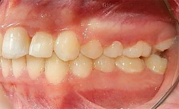 Fig. 24 Lateral izquierda