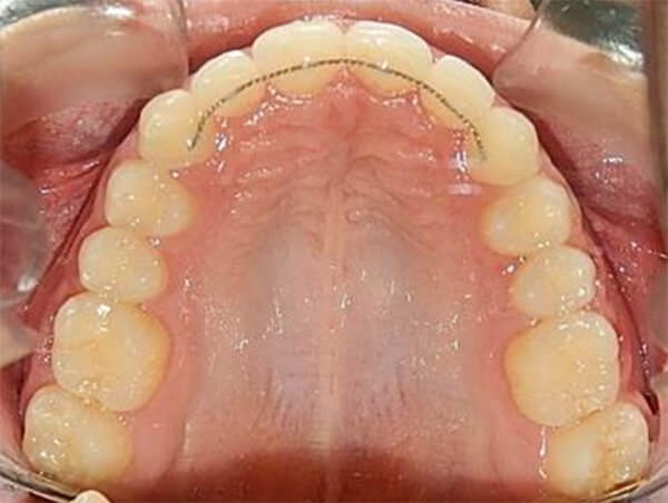 Fig. 25 Oclusal superior