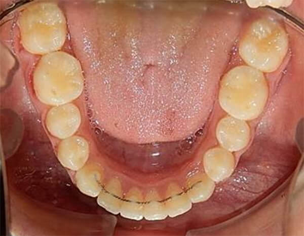 Fig. 26 Oclusal inferior