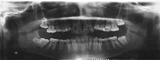 Figura 7 Radiografia