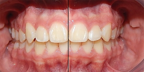 Fig. 16 Intraoral frente