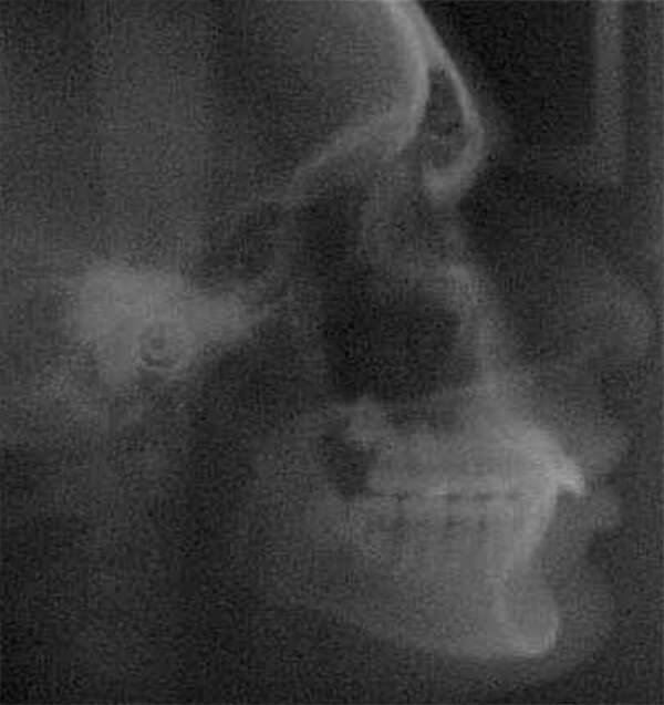 Fig. 8 Rx lateral