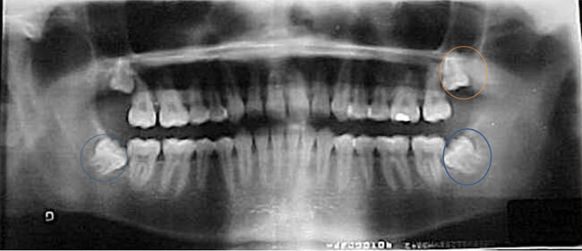 Fig. 9 Rx. panorámica de inicio