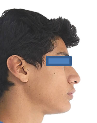 Fig. 10 Perfil inicio