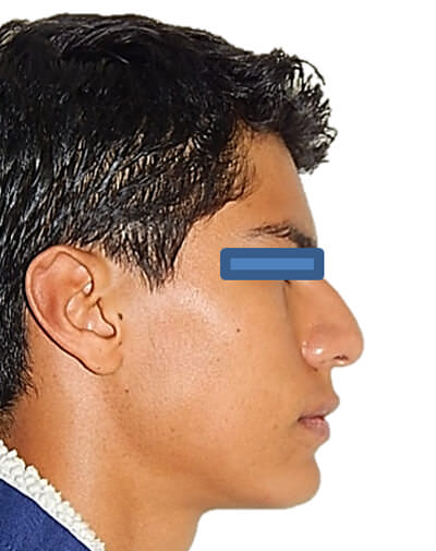 Fig. 11 Comparativa perfil progreso