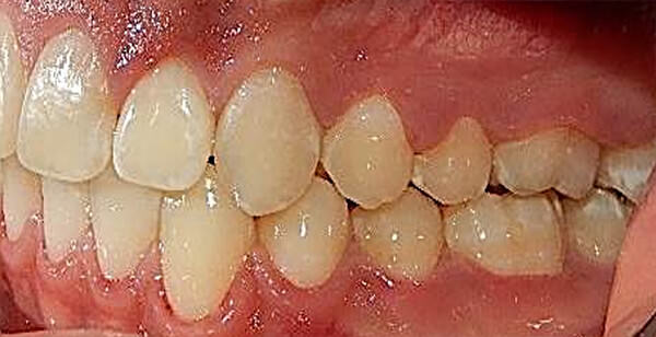 Fig. 25 Izquierda