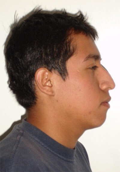 Foto inicial de perfil