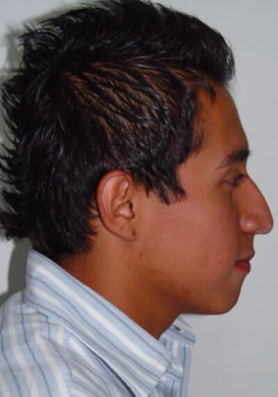 Foto final de perfil