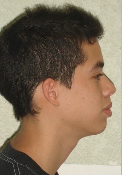 Foto inicial de perfil