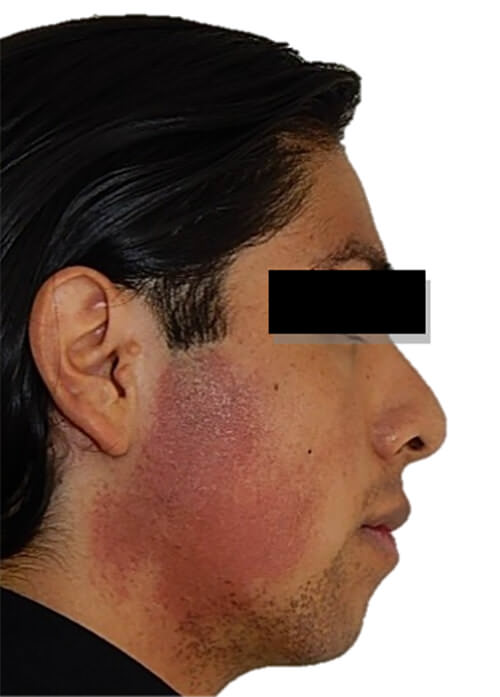 Fig. 2 perfil
