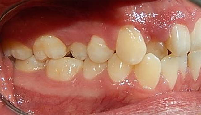 Fig. 4 Lateral derecha