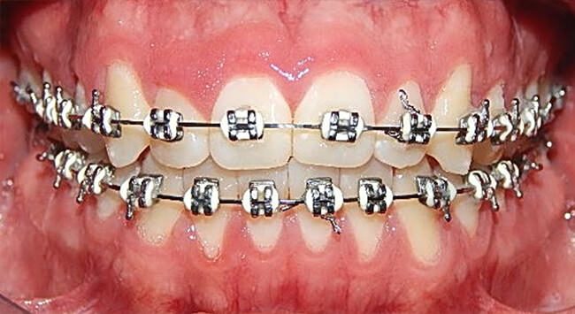 Fig. 8 Intraoral Frente progreso
