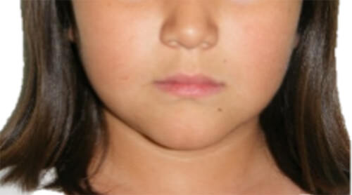 Fig. 1 Frente