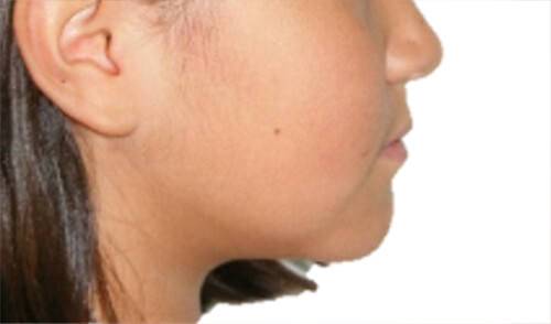 Fig. 2 Perfil derecho