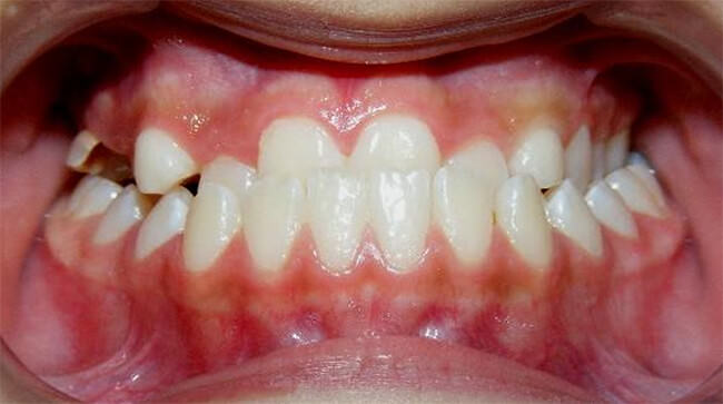 Fig.4 Frente