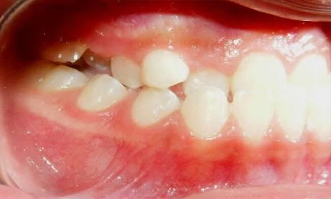 Fig 5 Lateral derecha
