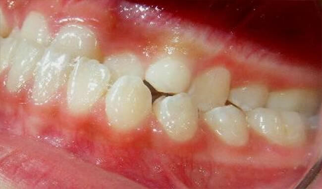 Fig 6 Izquierda