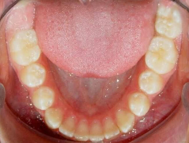 Fig. 8 Oclusal inferior
