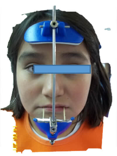 Fig. 13 Frente