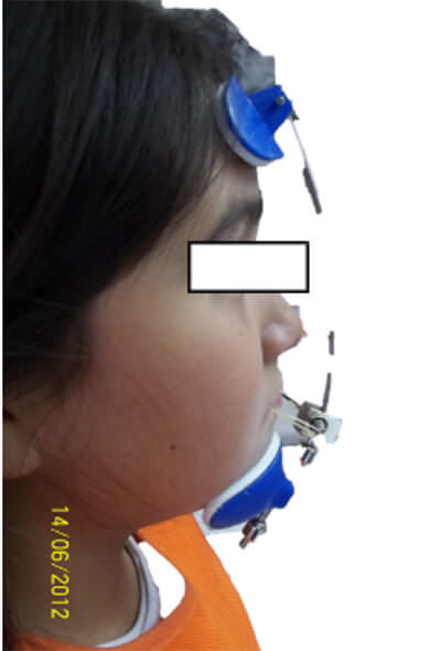 Fig. 14 Perfil