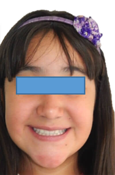 Fig. 15 Frente