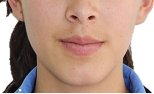 Fig. 1.- Frente