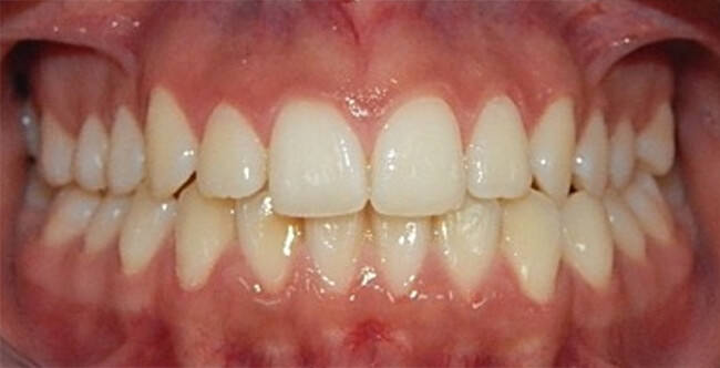 Fig. 3.-Extraoral de frente
