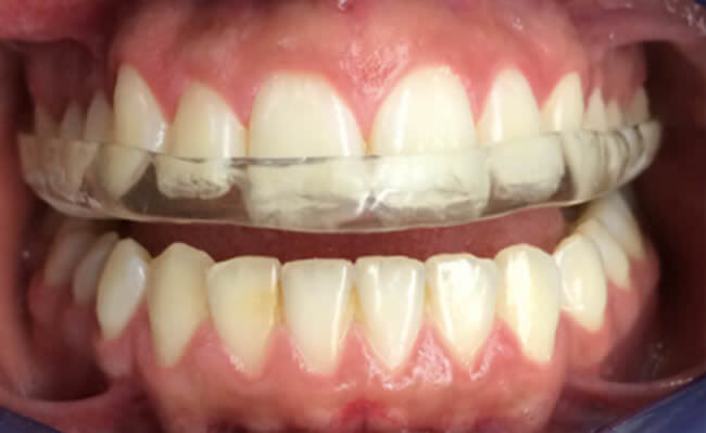 Figura 8.- Intraoral de Frente
