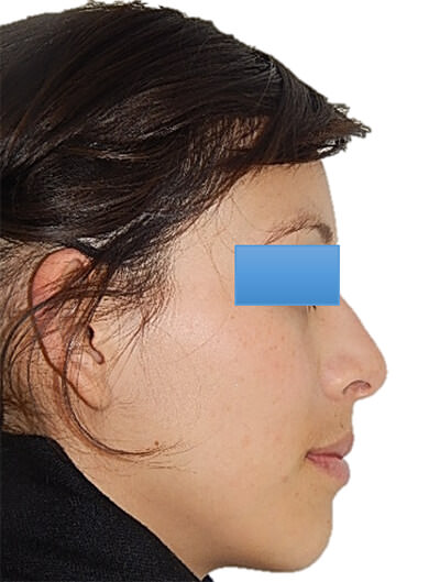 Figura 14.- Perfil